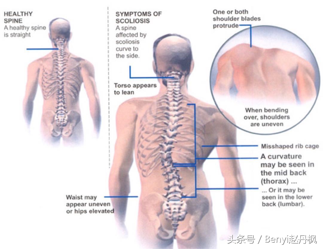 减缓腰椎疼痛的药,减缓腰椎间盘突出疼痛的按摩手法
