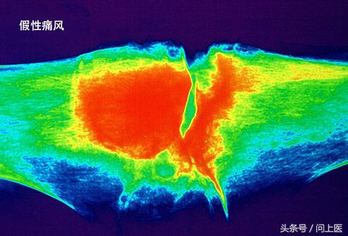 膝盖疼痛的原因和解决方法,膝盖上下楼疼痛的原因和解决方法