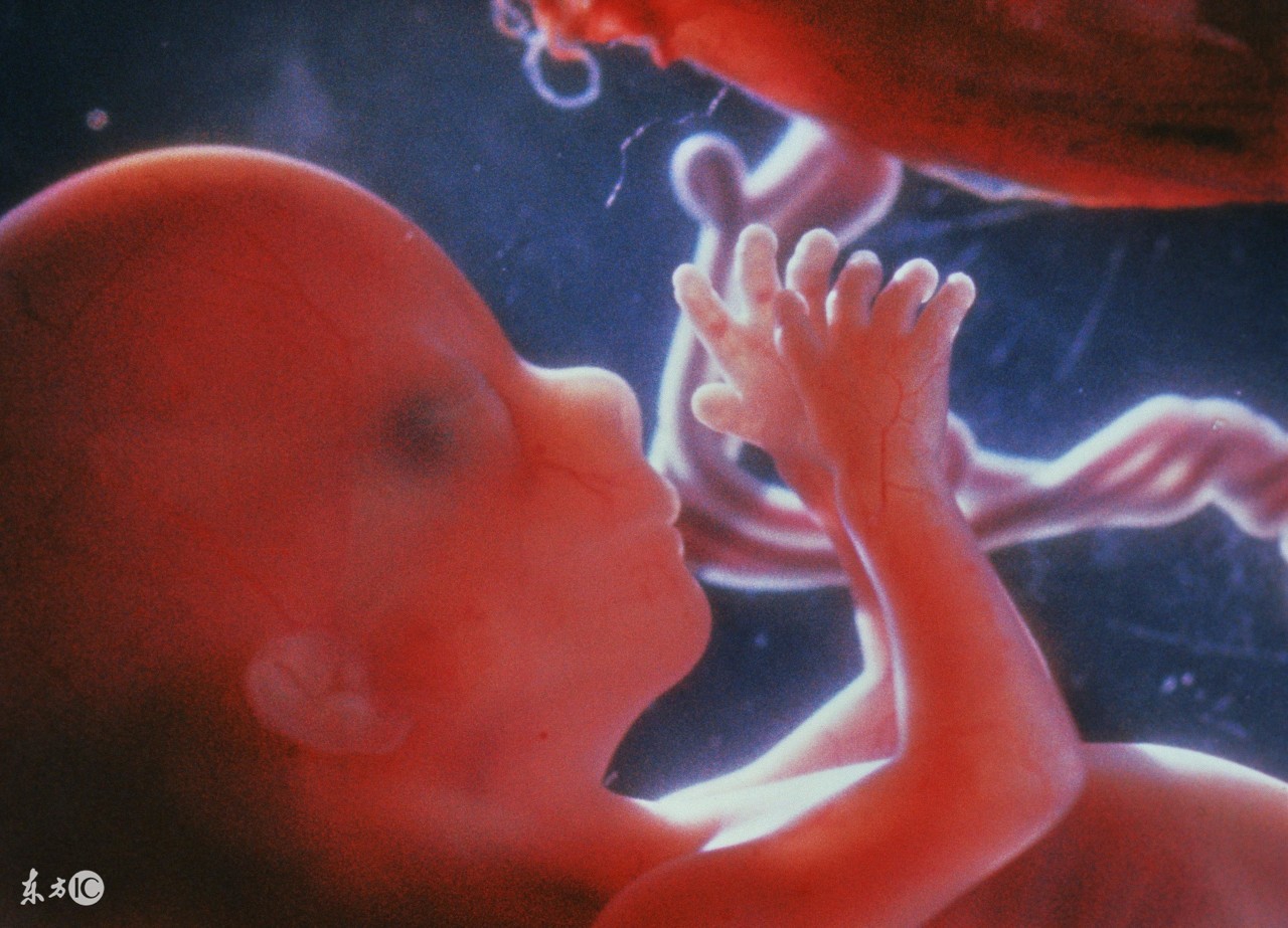 唐筛,无创DNA,羊水穿刺有什么区别?