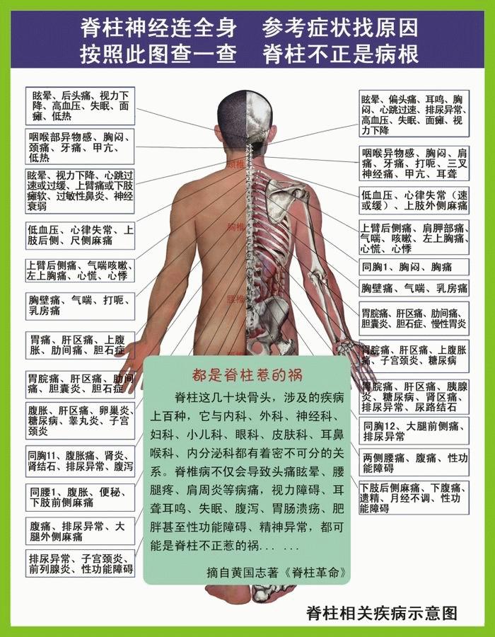 正常范围内的脊柱侧弯图片,脊柱侧弯的凸侧和凹侧