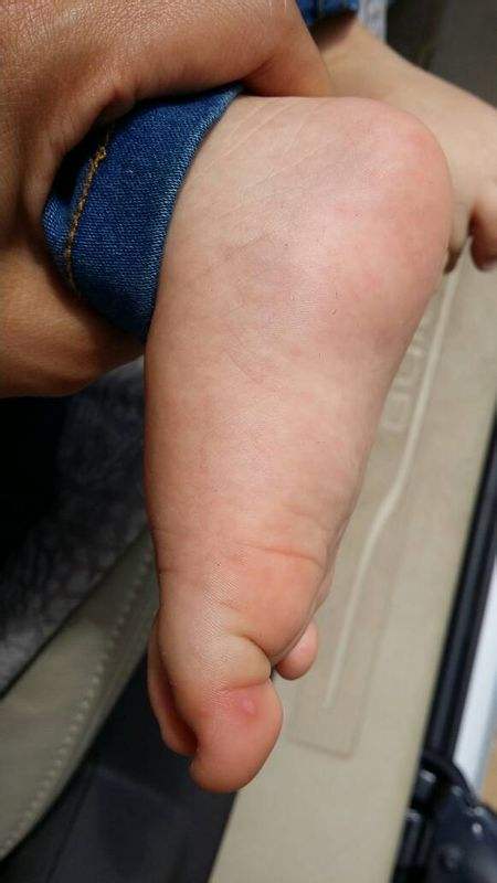 怀孕期很疼的人,怀孕期的孕妈会有很多症状