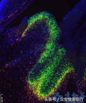 lncrna研究思路,如何研究lncrna的作用机制