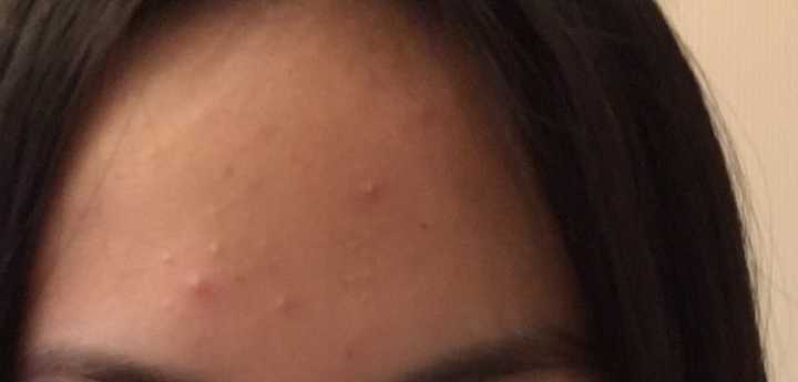 仙女皮肤修复方法,帮仙女们解决各种皮肤问题