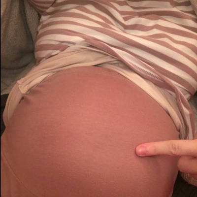 怀孕期很疼的人,怀孕期的孕妈会有很多症状