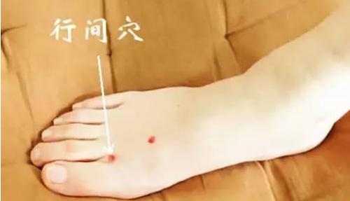 只要姨妈正常是不是没什么炎症,从来不会姨妈痛