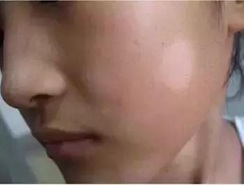 小孩睡觉牙齿咯咯响是有蛔虫吗,小孩睡着了牙齿咬得咯咯叫