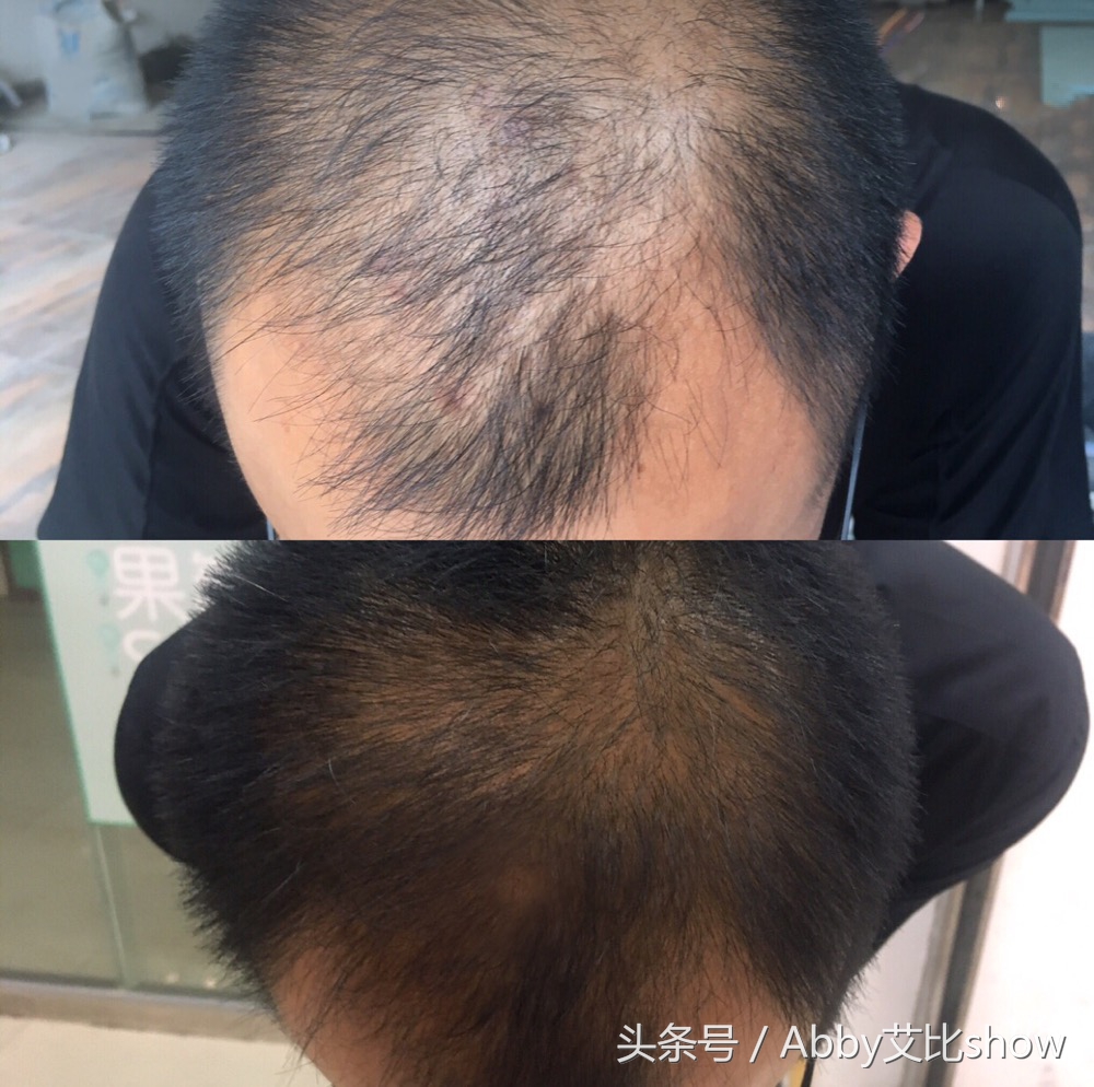 脱发滋润洗发水推荐,脱发救星防脱育发洗发水