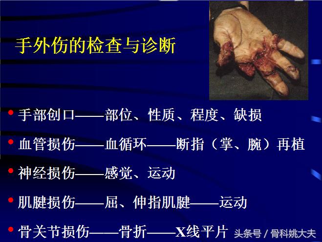 手肌腱损伤图片,手外伤神经肌腱损伤怎么定残