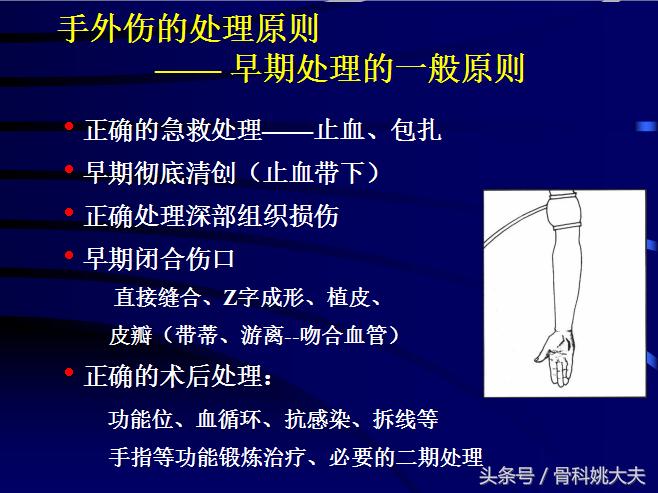 手肌腱损伤图片,手外伤神经肌腱损伤怎么定残