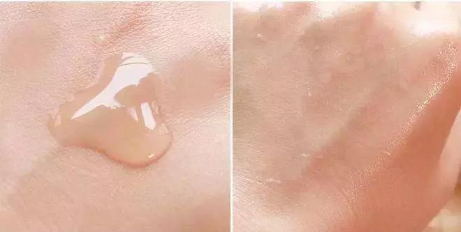 痘痘不长出来也不消怎么办,脸上的痘印持久不消