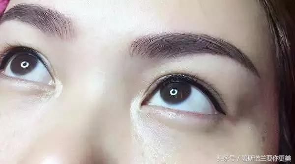 做了美瞳线双眼皮不见了,美瞳线做完1-7天肿胀的对比图