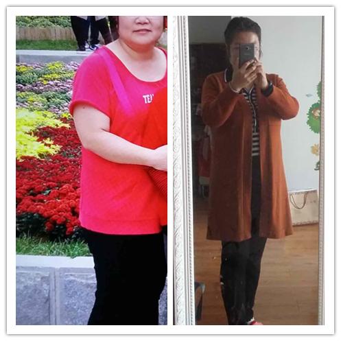 医学营养治疗减脂减重原理,医学营养减重门诊