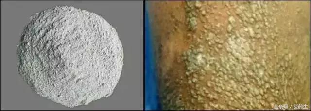 舌尖上的中医药论文,舌尖上的医疗