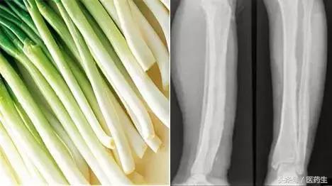 舌尖上的中医药论文,舌尖上的医疗