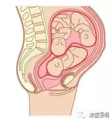 女人有两个子宫怎么办,有两个子宫怎么治疗