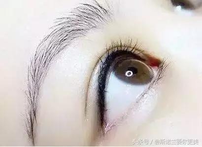 做了美瞳线双眼皮不见了,美瞳线做完1-7天肿胀的对比图