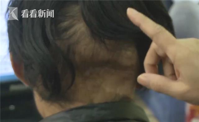 21岁贵州小伙抗癌四年,29岁小伙抗癌四年临终信视频