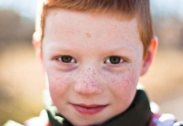 绉嬭幉闈㈤儴鎶よ偆,绉嬭幉缇庡