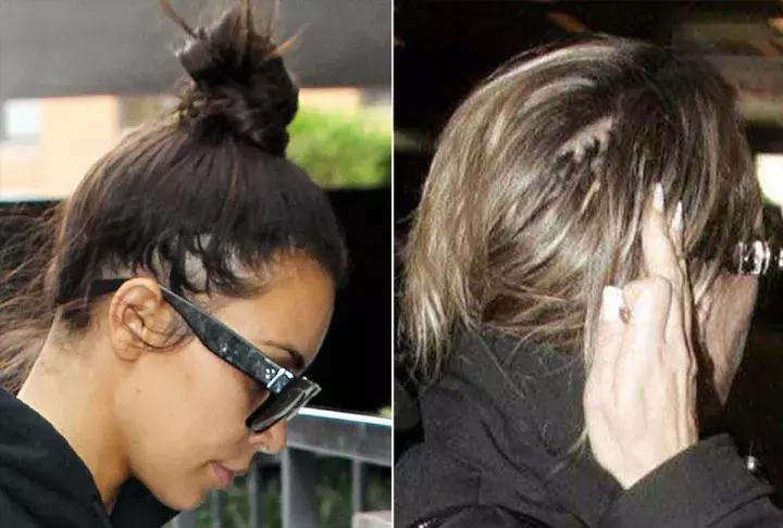 总是担心自己要秃了,怀疑自己越来越秃