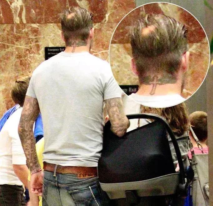 总是担心自己要秃了,怀疑自己越来越秃