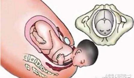 胎宝宝头大身小怎么办,胎宝宝头大的原因有哪些