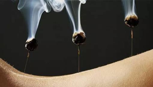 艾灸的正确时间和艾灸方法,艾灸前注意事项有哪些