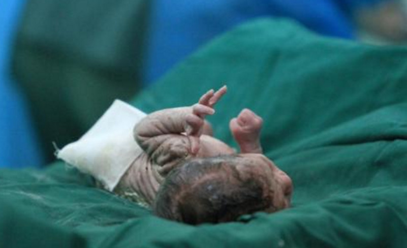 为什么顺产还要挨一刀,听听这些过来妈咪谈感受!