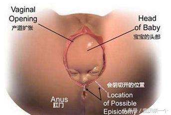 胎宝宝头大身小怎么办,胎宝宝头大的原因有哪些