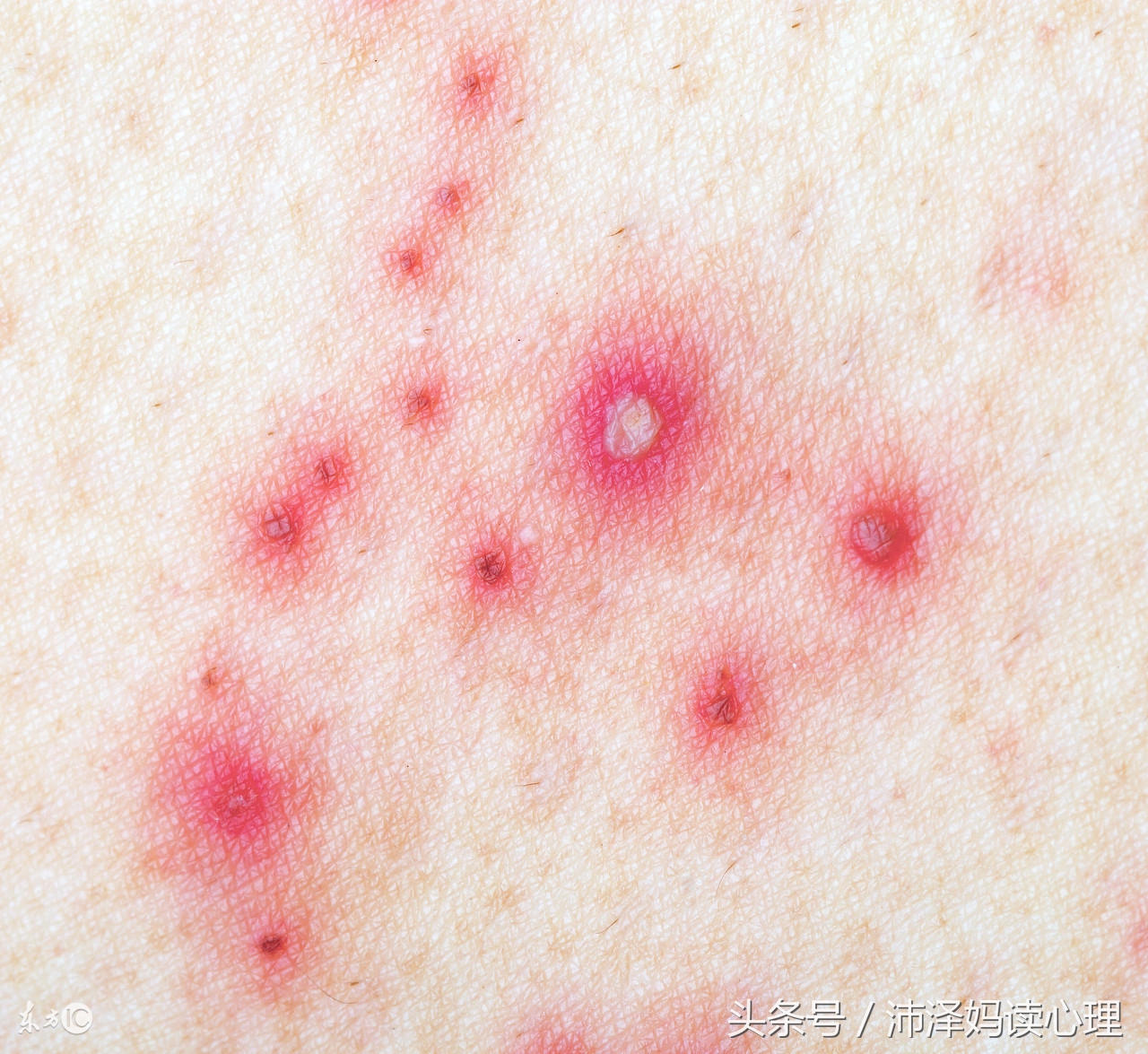 儿童最常见的十大传染病,儿童传染病最严重的排行