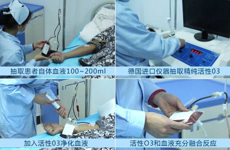 中国有没有真正的中医治疗银屑病,银屑病药浴推荐