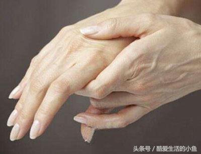 小拇指和无名指手指发麻什么原因,睡觉醒后左手手指发麻是什么原因