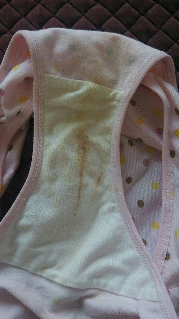 3岁女宝宝裤子有血,三周岁女宝宝裤子上有血滴