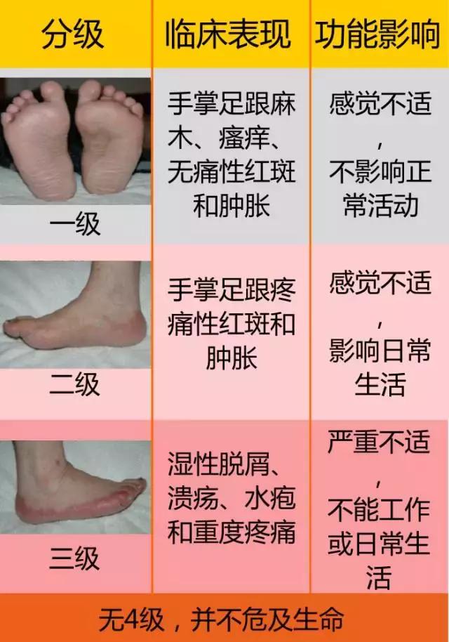 肿瘤患者手足综合征的预防和治疗,手足综合征金点子