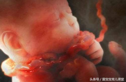 怀孕38周胎儿绕颈2周怎样能绕过来,38周脐带绕颈2圈需要提前剖腹产吗