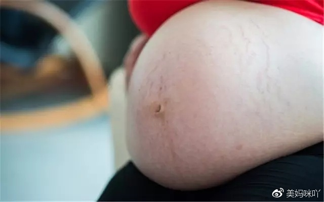 孕妇出现哪些情况必须剖腹产,孕妇临盆的突发情况