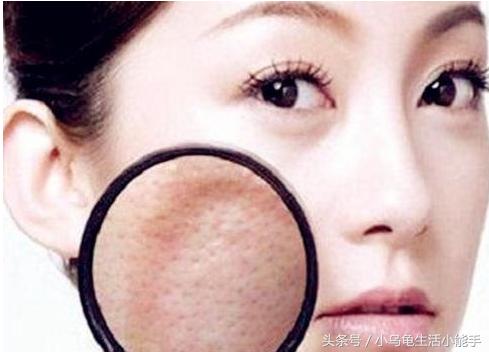 最简单的收缩毛孔方法,十大最有效收缩毛孔方法