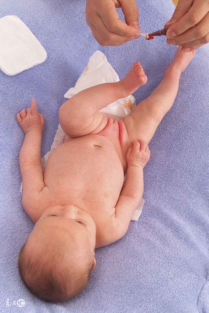 应对尿布疹,这些神器该备着,收好不谢