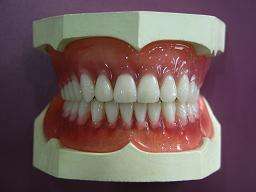 金属托假牙跟树脂托假牙哪种好,哪种假牙是比较好的