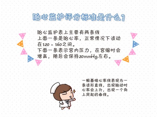 有宫缩的胎心监护图,胎心监护图fmp是什么