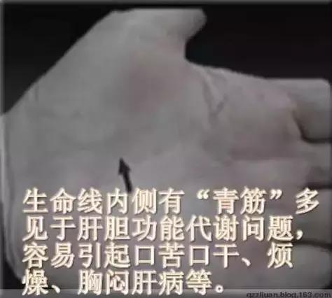 各类青筋的分布和原因,治爆青筋的中药方法