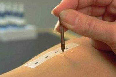 皮肤过敏查过敏源多少钱,皮肤过敏怎么测过敏源