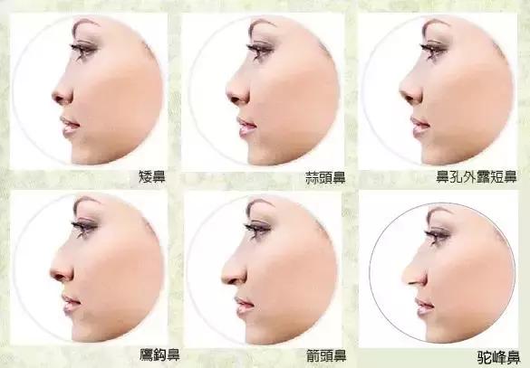 隆鼻手术哪种鼻型不适合,隆鼻手术最大的危险是全麻吗