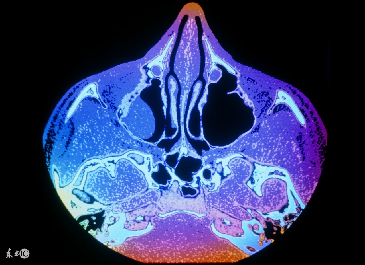诊断子宫颈息肉较准确的方法有哪些呢