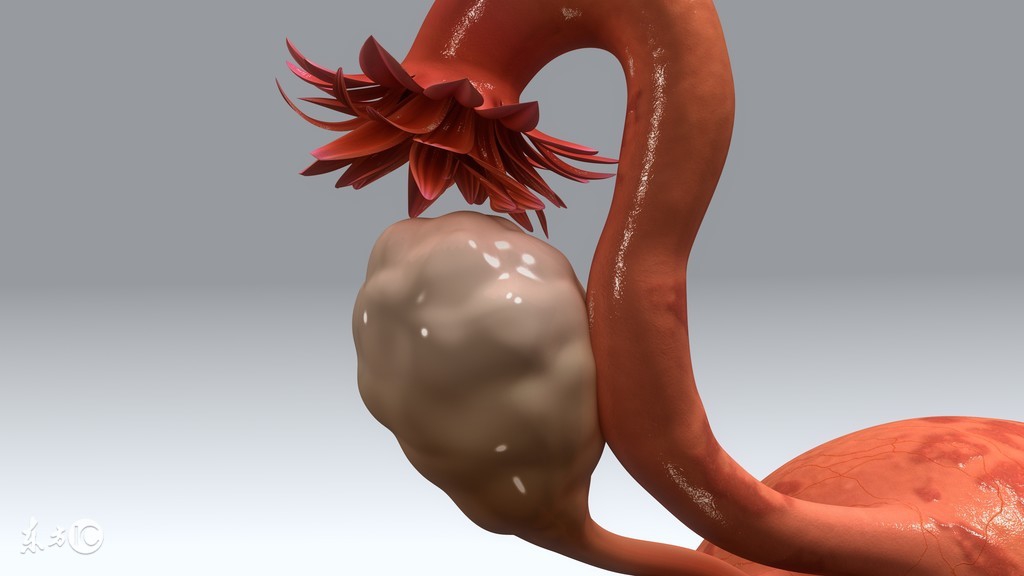 诊断子宫颈息肉较准确的方法有哪些呢