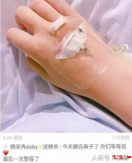 韩安冉这次鼻子修复是在哪修复的,韩安冉现在做的鼻子是什么款的
