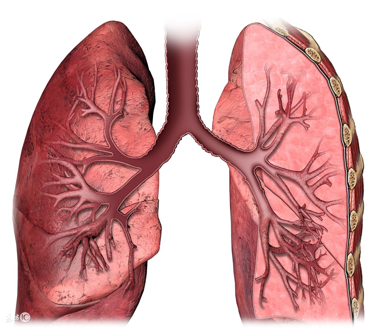 肺腺癌做什么手术最好,肺腺癌转移到胸膜可以手术治疗吗