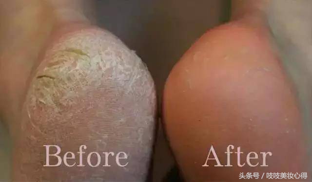 吱吱の秋季爱用物清单，每一款都好用到哭！