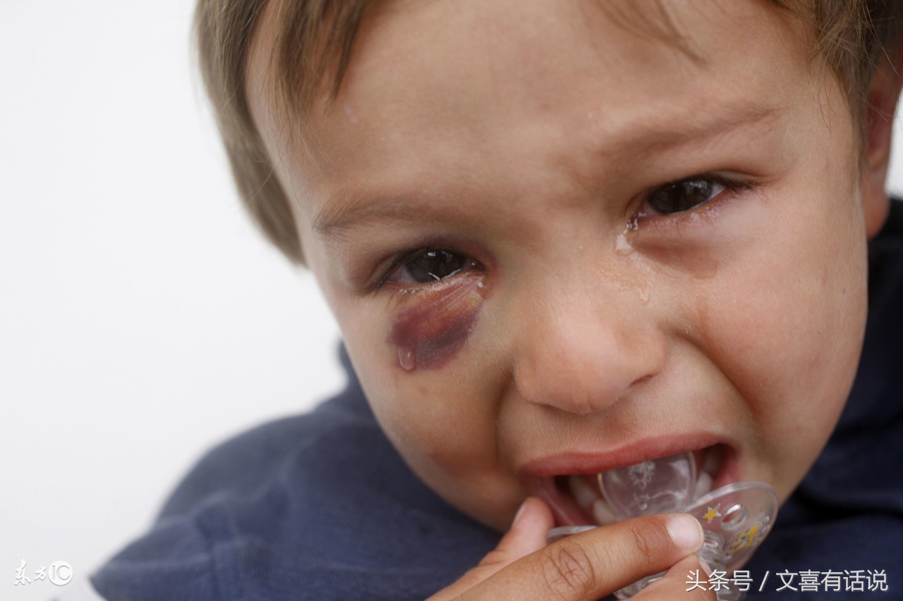 剖宫产对子宫损伤大,剖宫产会不会损伤子宫内膜