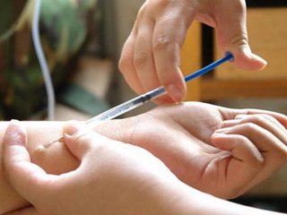 关于药物皮试及皮试方法