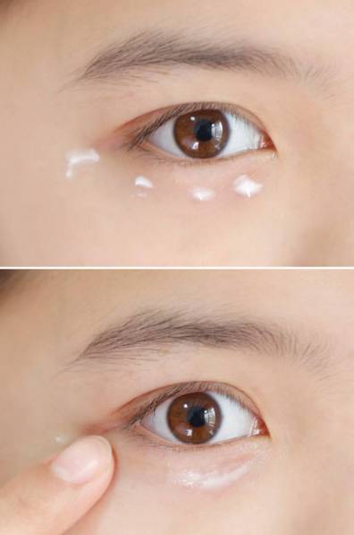 有黑眼圈细纹脂肪粒怎么办,去黑眼圈脂肪粒最有效的方法